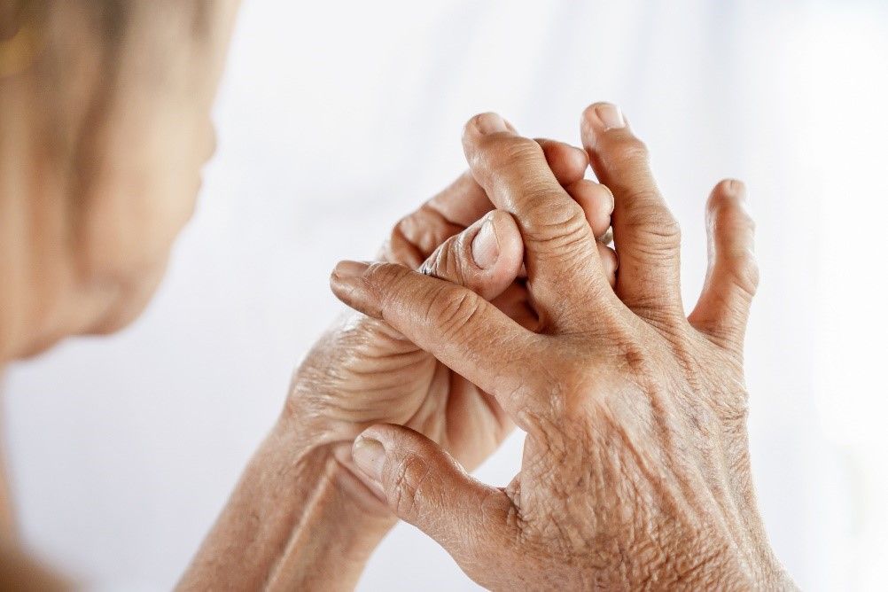 ¿Conoce qué es la Artritis  Reumatoide?